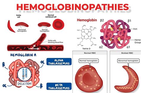 BETA HEMOGLOBINOPATHIES .